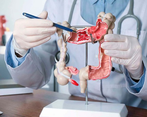 Una dieta reducida en almidón y sacarosa para el síndrome del intestino irritable